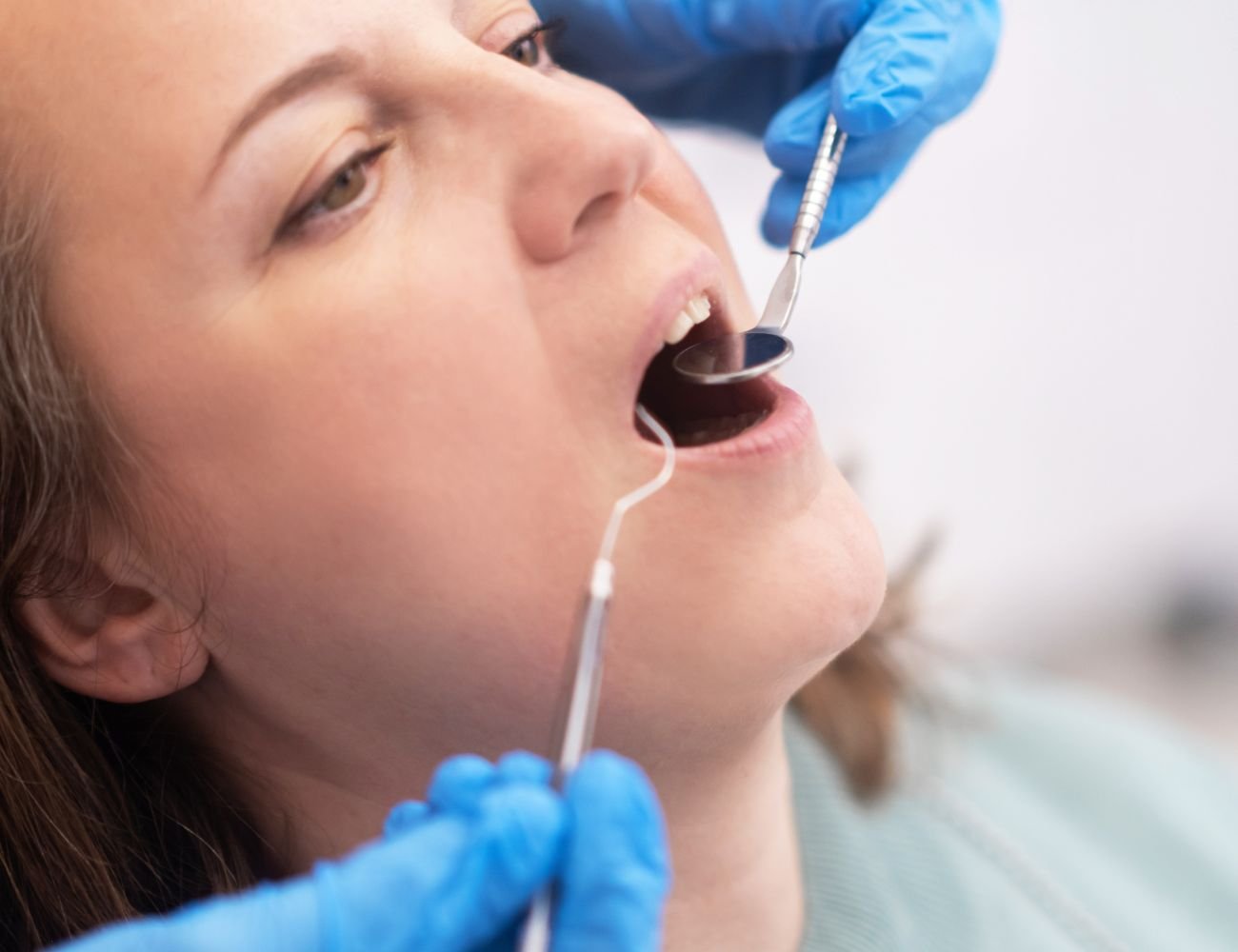 Periodoncia